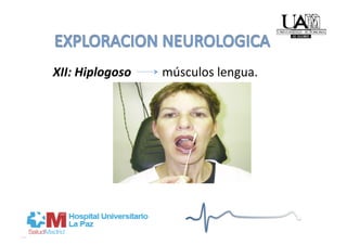     XII: Hiplogoso          músculos lengua.  
 