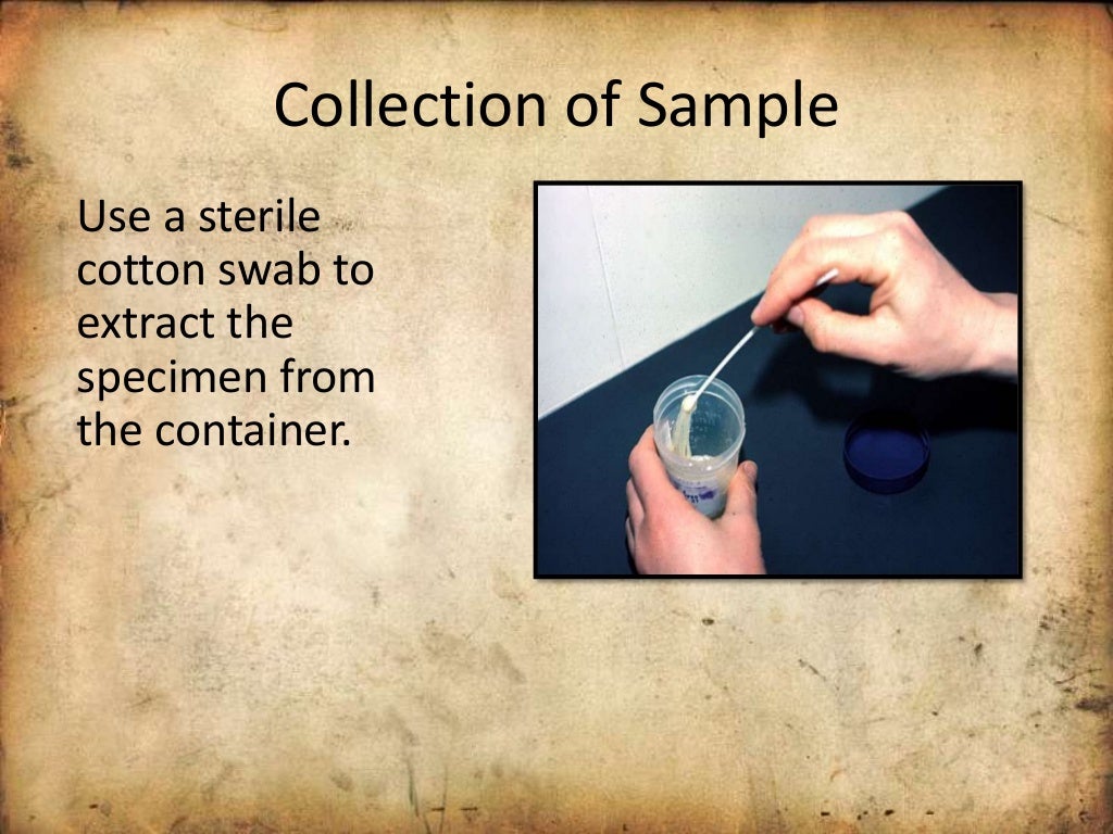 Use of Sputum sample for diagnosis of disease, interpretation, treatm…