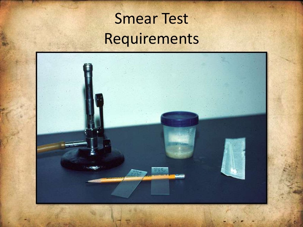 Use of Sputum sample for diagnosis of disease, interpretation, treatm…