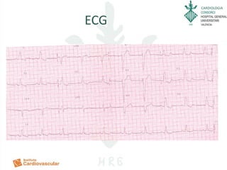 CARDIOLOGIA
ECG
 