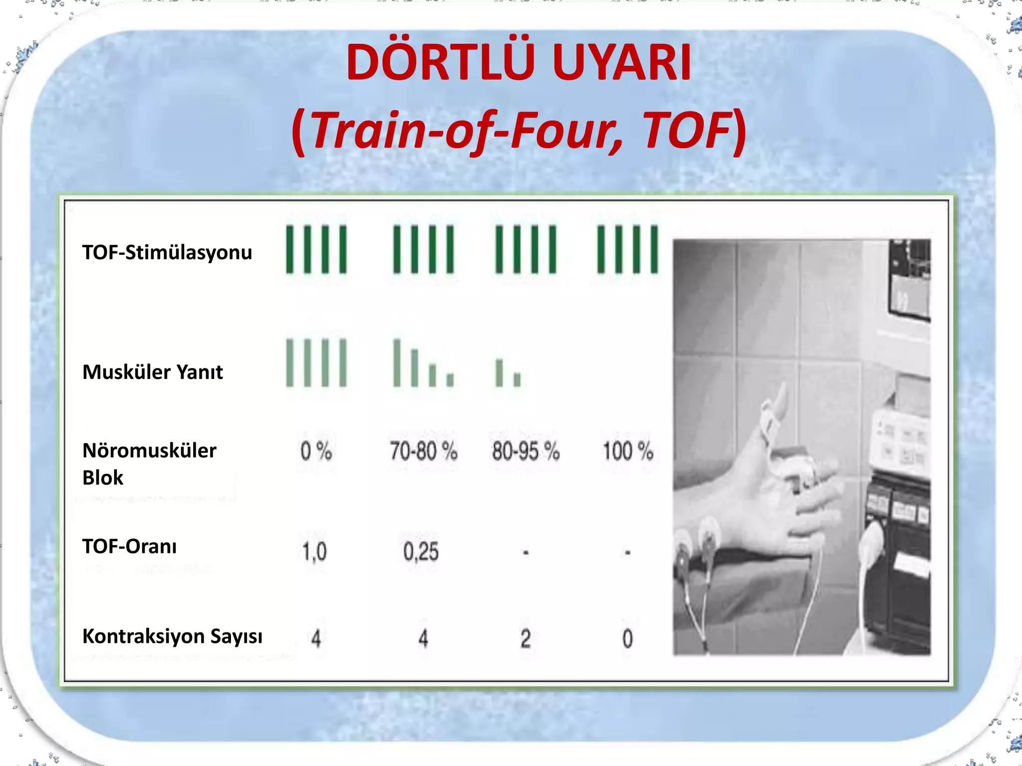 DÖRTLÜ UYARI
(Train-of-Four, TOF)
TOF-Stimülasyonu
Musküler Yanıt
Nöromusküler
Blok
TOF-Oranı
Kontraksiyon Sayısı
 