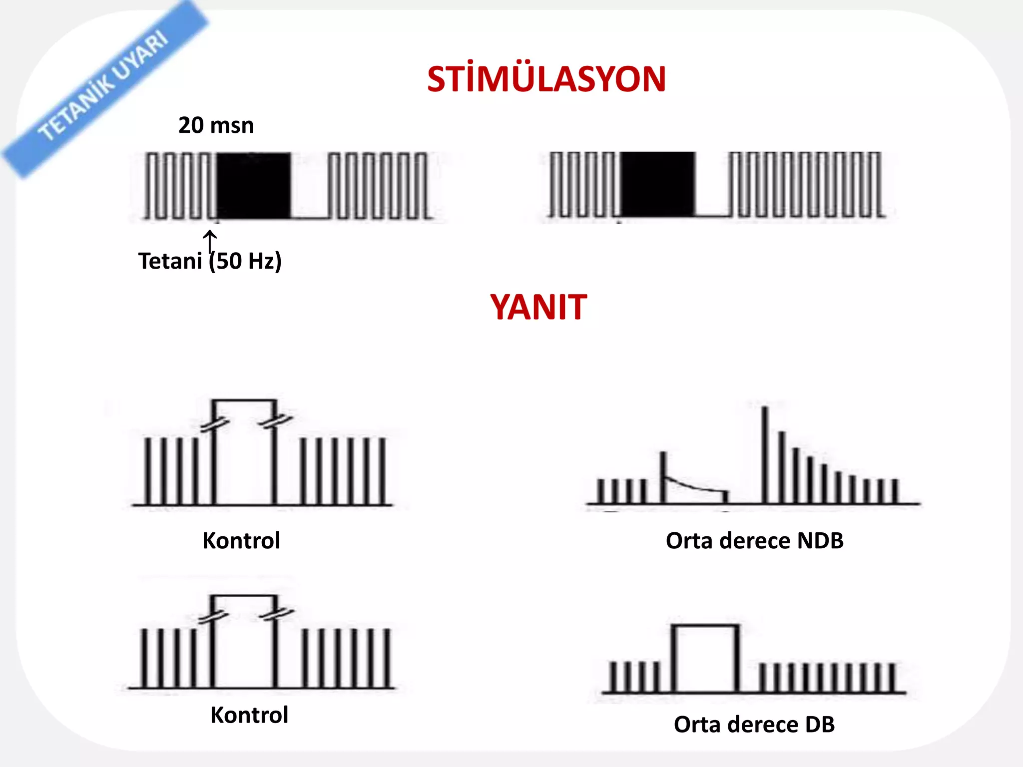 STİMÜLASYON
20 msn
Tetani (50 Hz)
YANIT
Kontrol
Kontrol
Orta derece NDB
Orta derece DB

 