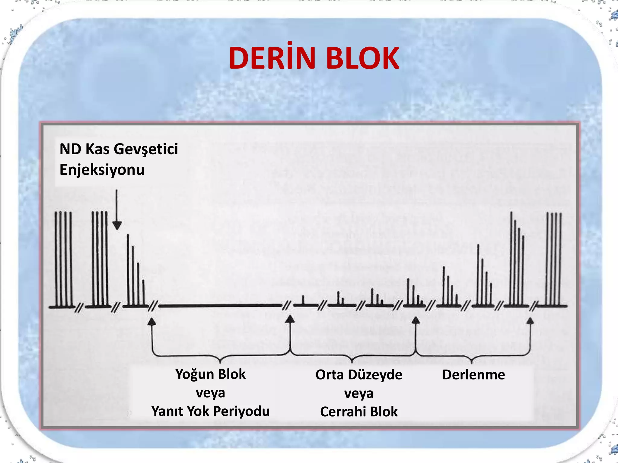 DERİN BLOK
ND Kas Gevşetici
Enjeksiyonu
Yoğun Blok
veya
Yanıt Yok Periyodu
Orta Düzeyde
veya
Cerrahi Blok
Derlenme
 