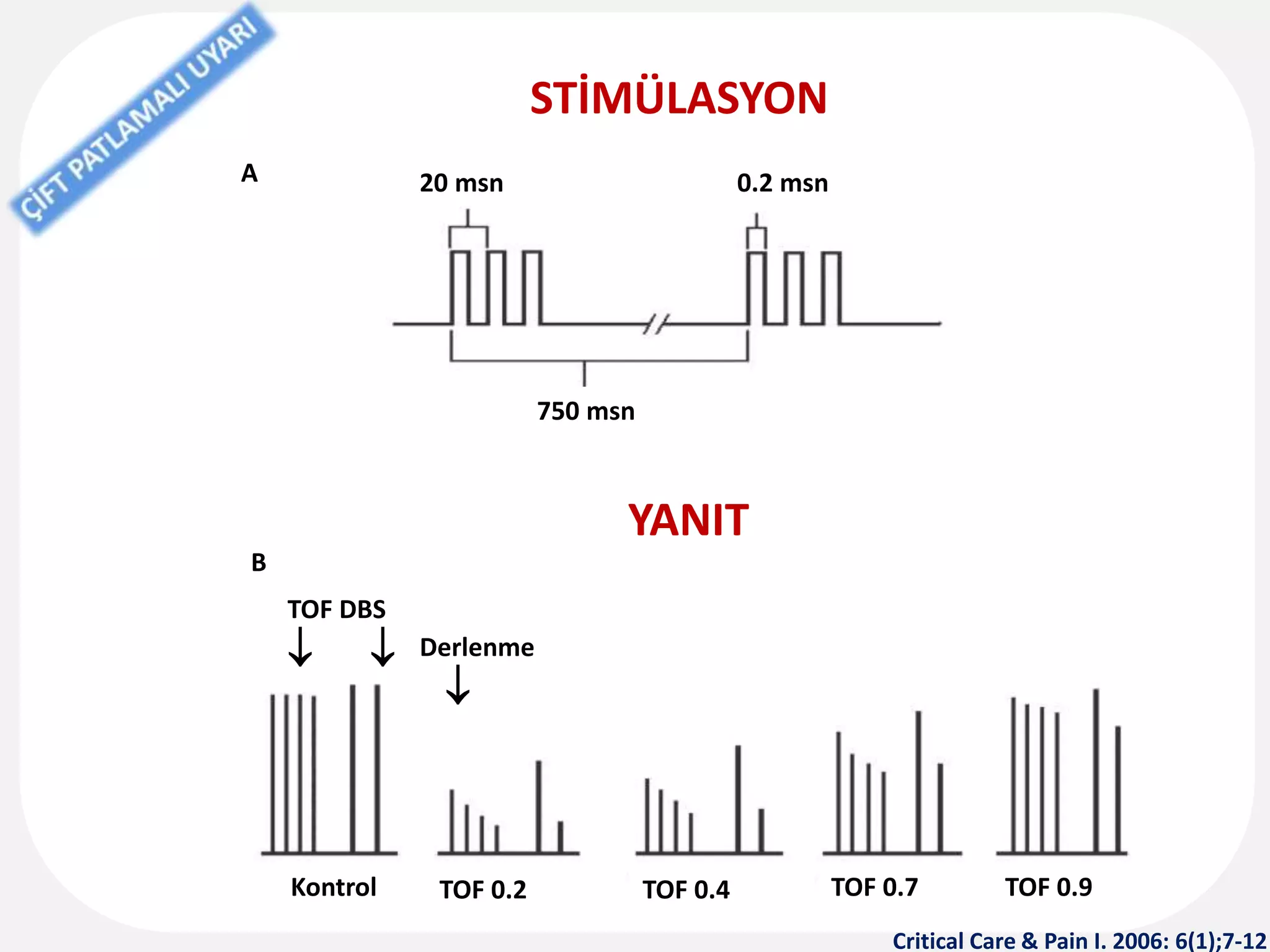 STİMÜLASYON
YANIT
TOF DBS
  Derlenme

Kontrol
A
B
TOF 0.2 TOF 0.4 TOF 0.7 TOF 0.9
20 msn 0.2 msn
750 msn
Critical Care & Pain I. 2006: 6(1);7-12
 