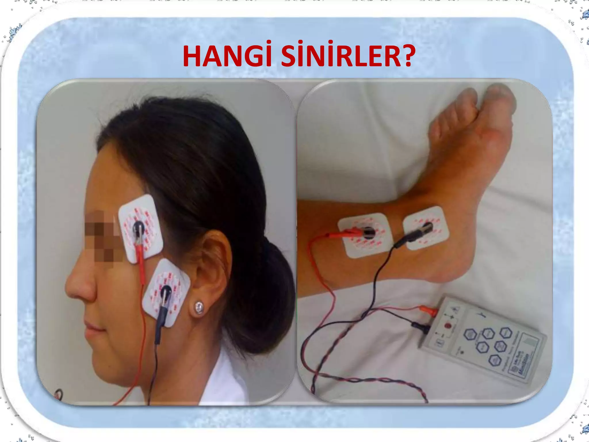 Ulnar sinir
HANGİ SİNİRLER?
 