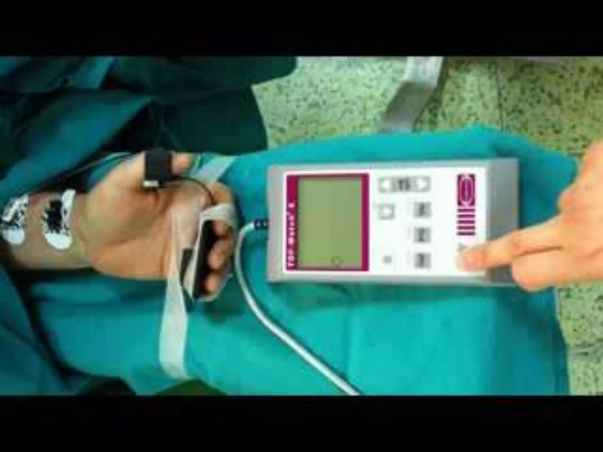 Nöromuskuler monitörizasyon