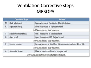 Ventilation Corrective steps
MRSOPA
 