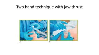 Two hand technique with jaw thrust
 