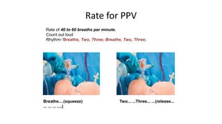 Rate for PPV
Rate of 40 to 60 breaths per minute.
Count out loud
Rhythm-“Breathe, Two, Three; Breathe, Two, Three;
Breathe....(squeeze) Two... ...Three... ...(release...
... ... ... ....)
 