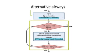 Alternative airways
 
