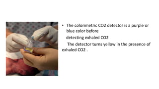 • The colorimetric CO2 detector is a purple or
blue color before
detecting exhaled CO2
The detector turns yellow in the presence of
exhaled CO2 .
 