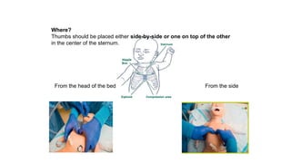Where?
Thumbs should be placed either side-by-side or one on top of the other
in the center of the sternum.
From the head of the bed From the side
 