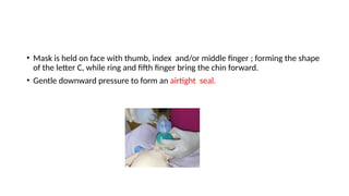 • Mask is held on face with thumb, index and/or middle finger ; forming the shape
of the letter C, while ring and fifth finger bring the chin forward.
• Gentle downward pressure to form an airtight seal.
 