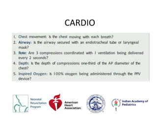 CARDIO
 