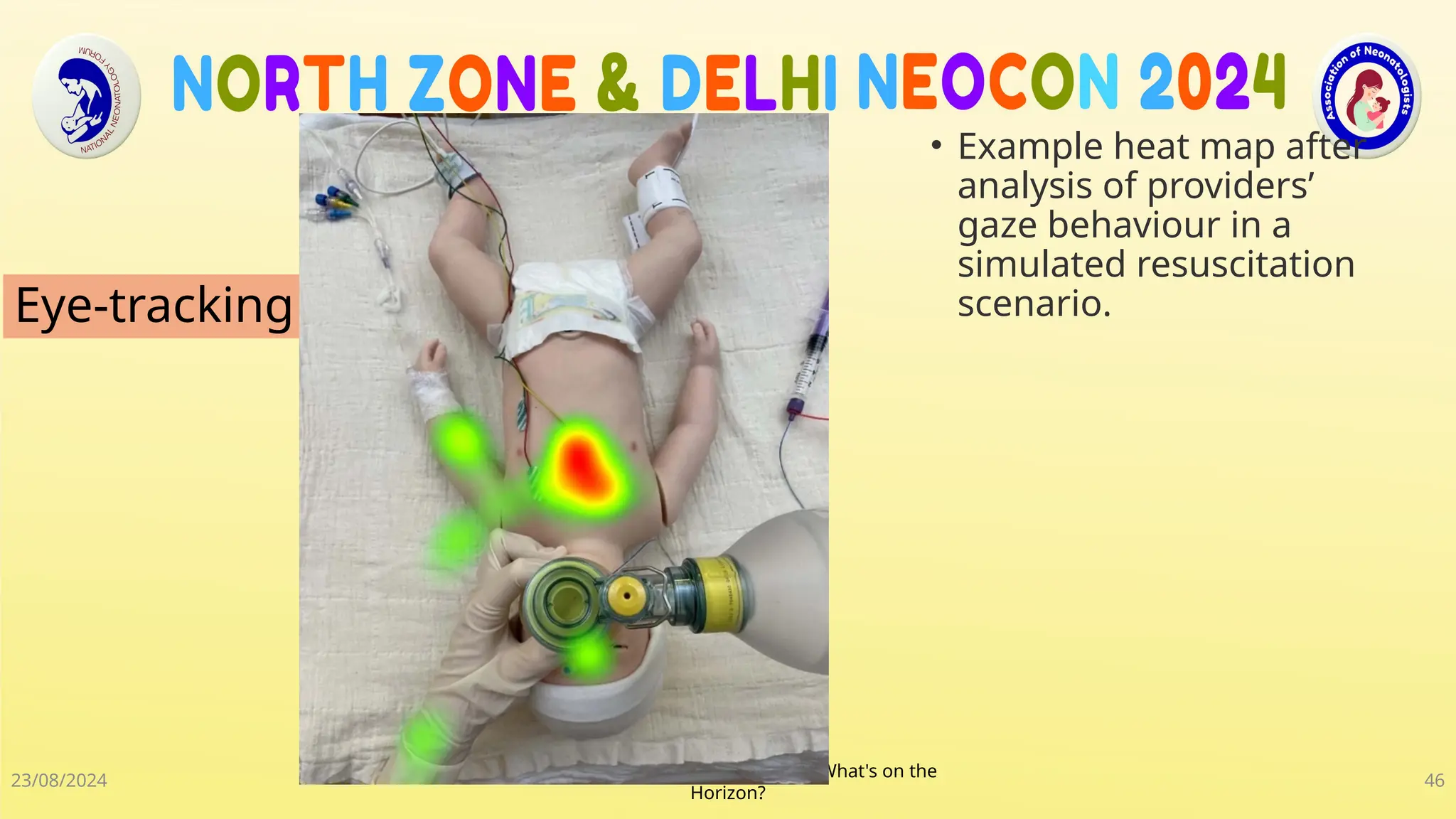 Neonatal R P Guidelines 2024 updated 28July2024.pptx