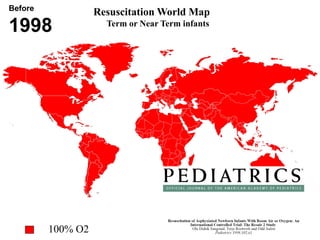Resuscitation World Map
Term or Near Term infants
100% O2
Before
1998
 