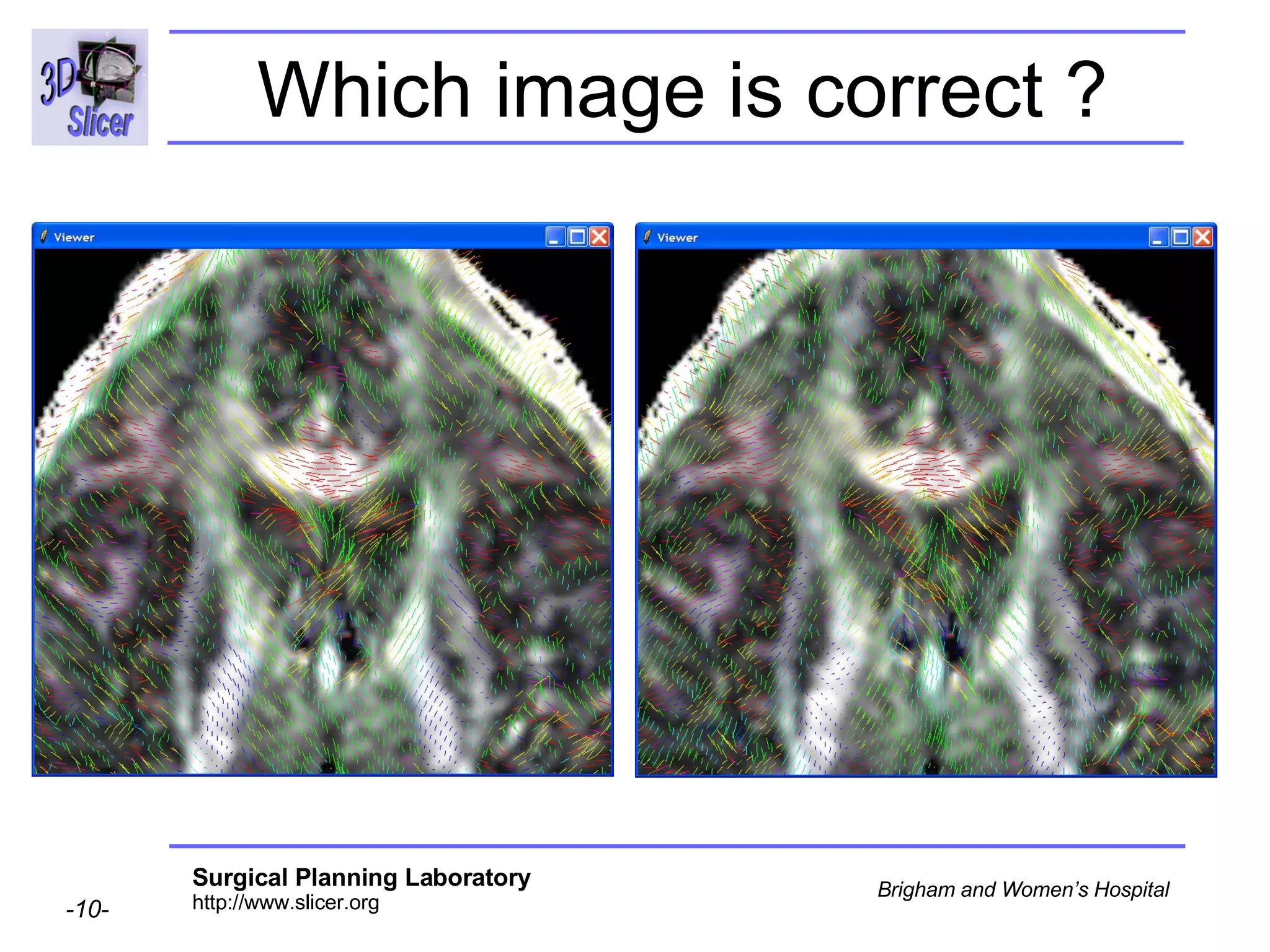 Which image is correct ? 