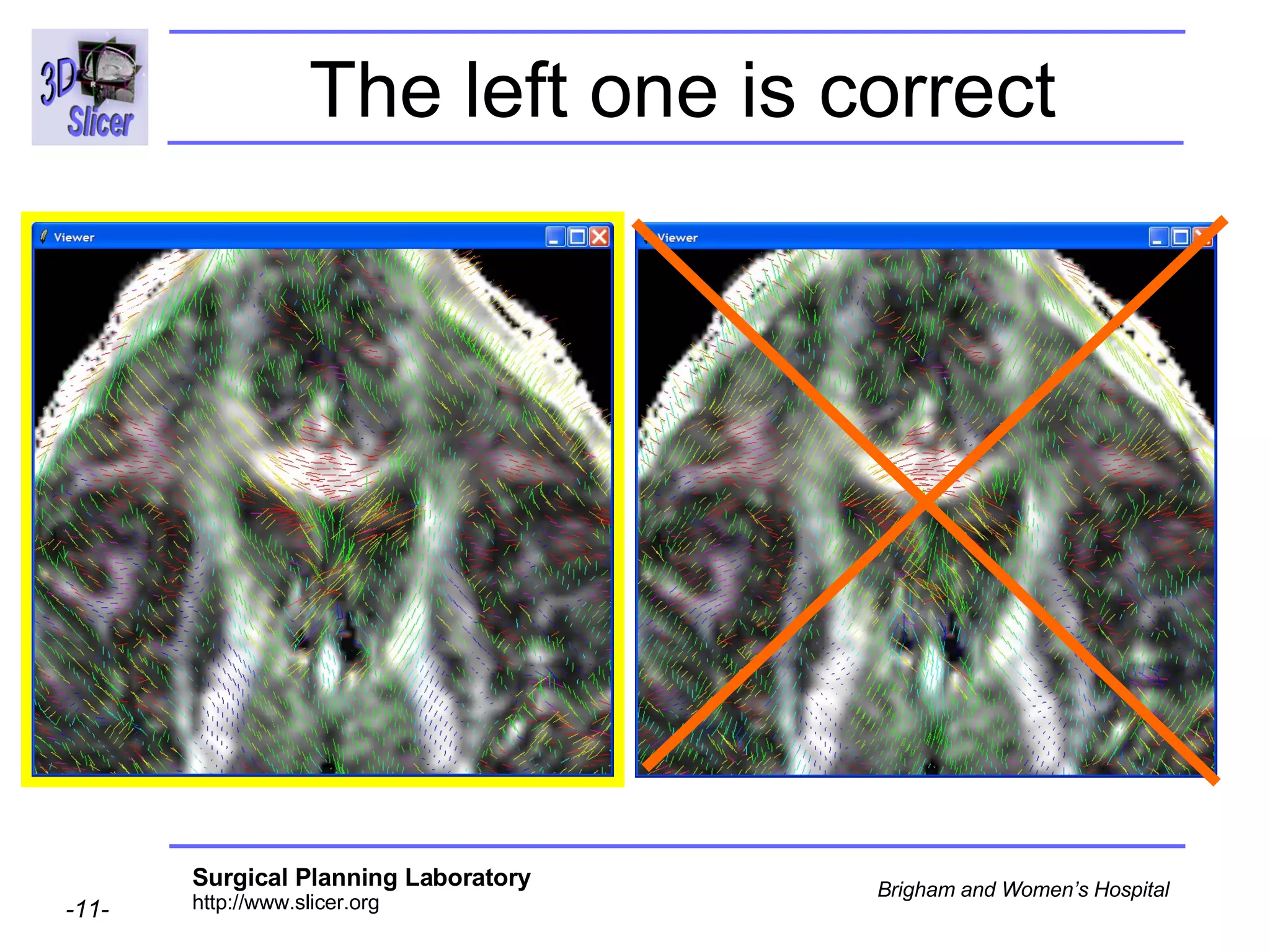 The left one is correct 
