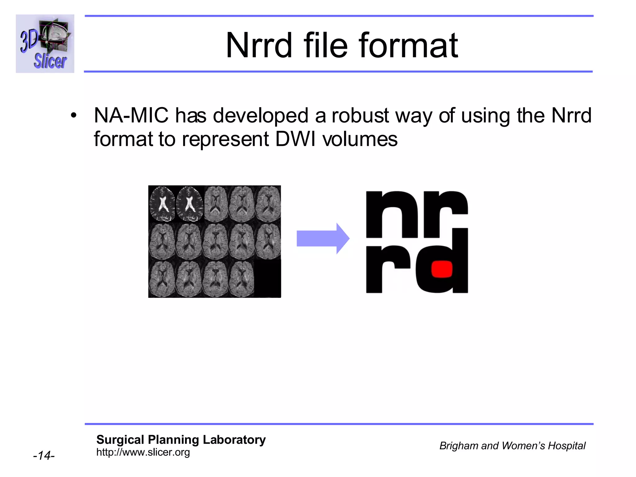 Nrrd file format NA-MIC has developed a robust way of using the Nrrd format to represent DWI volumes 