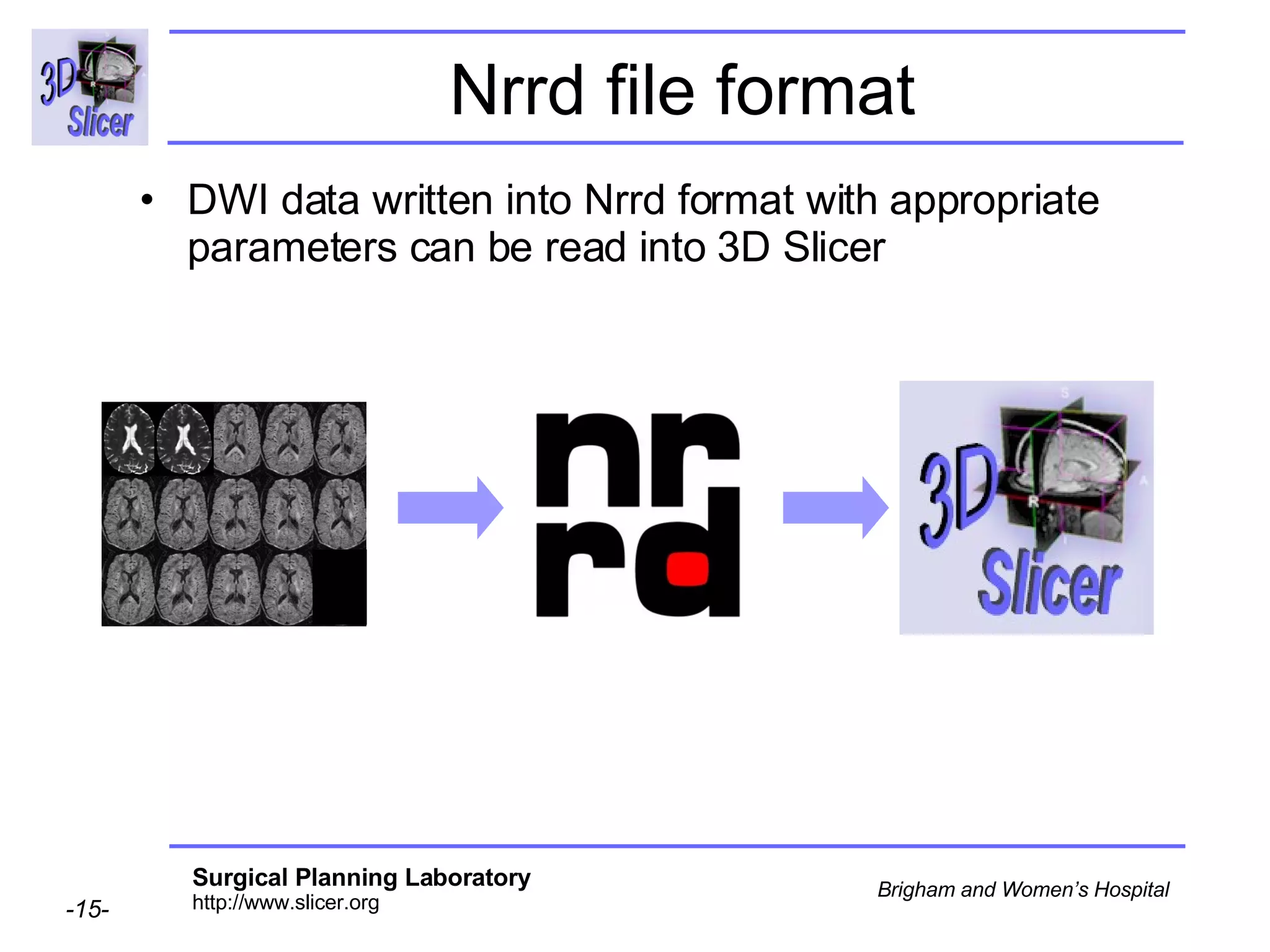 Nrrd file format DWI data written into Nrrd format with appropriate parameters can be read into 3D Slicer 