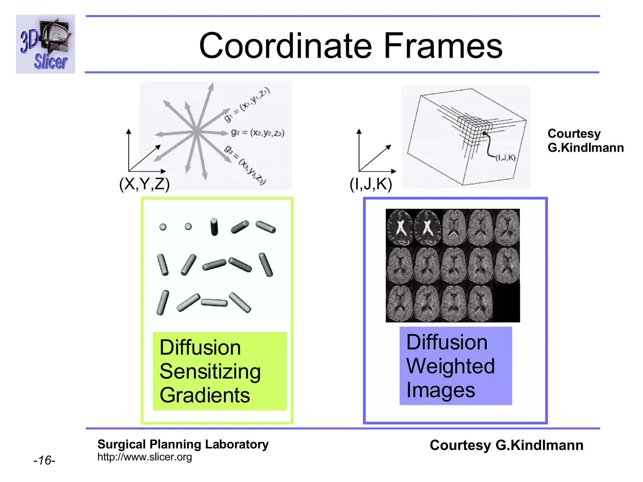 Coordinate Frames Diffusion Weighted  Images Diffusion Sensitizing Gradients  Courtesy G.Kindlmann Courtesy G.Kindlmann (X,Y,Z) (I,J,K) 