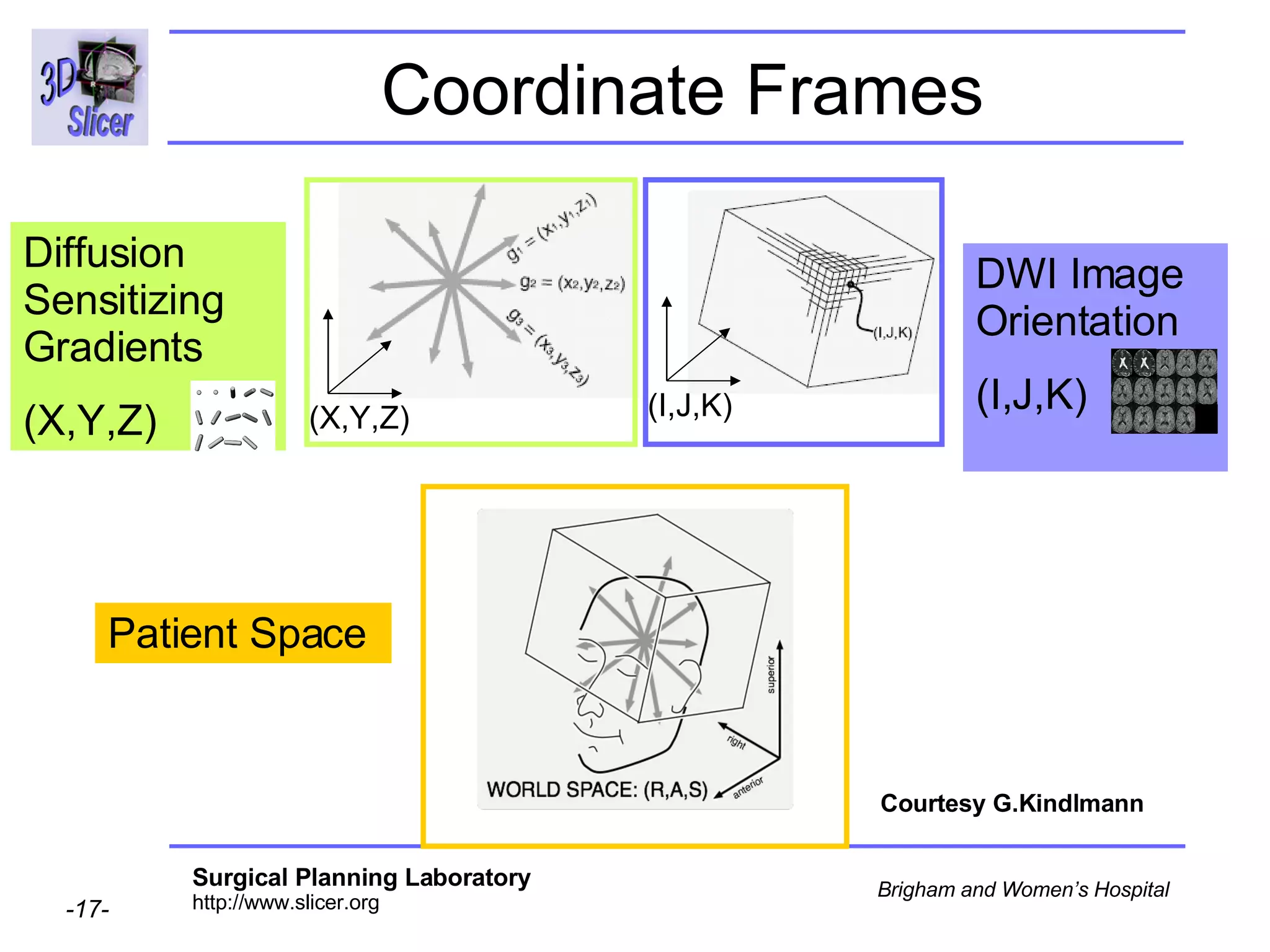 Coordinate Frames DWI Image Orientation (I,J,K)  Diffusion Sensitizing Gradients  (X,Y,Z) Patient Space Courtesy G.Kindlmann (X,Y,Z) (I,J,K) 