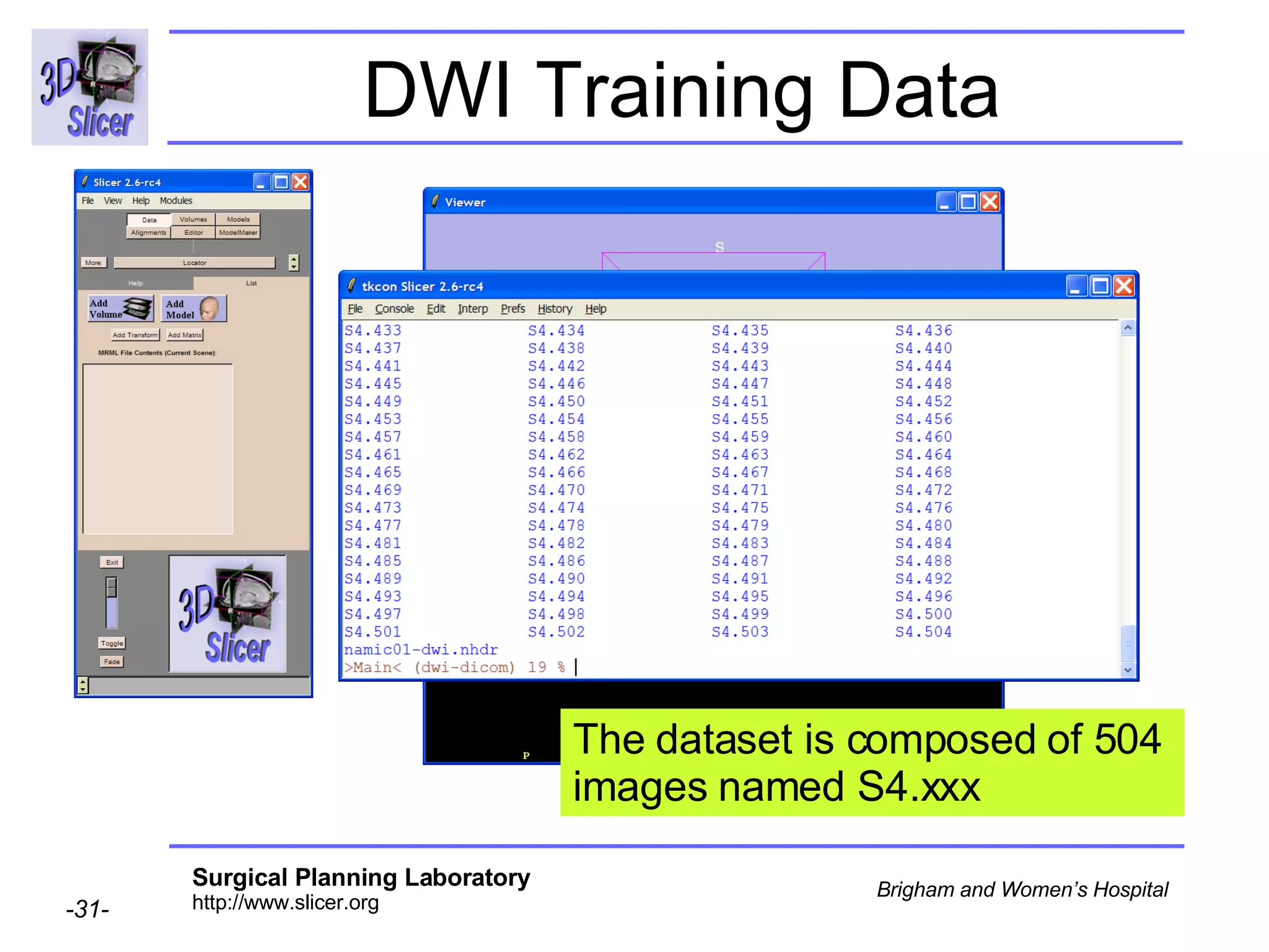 DWI Training Data The dataset is composed of 504 images named S4.xxx 