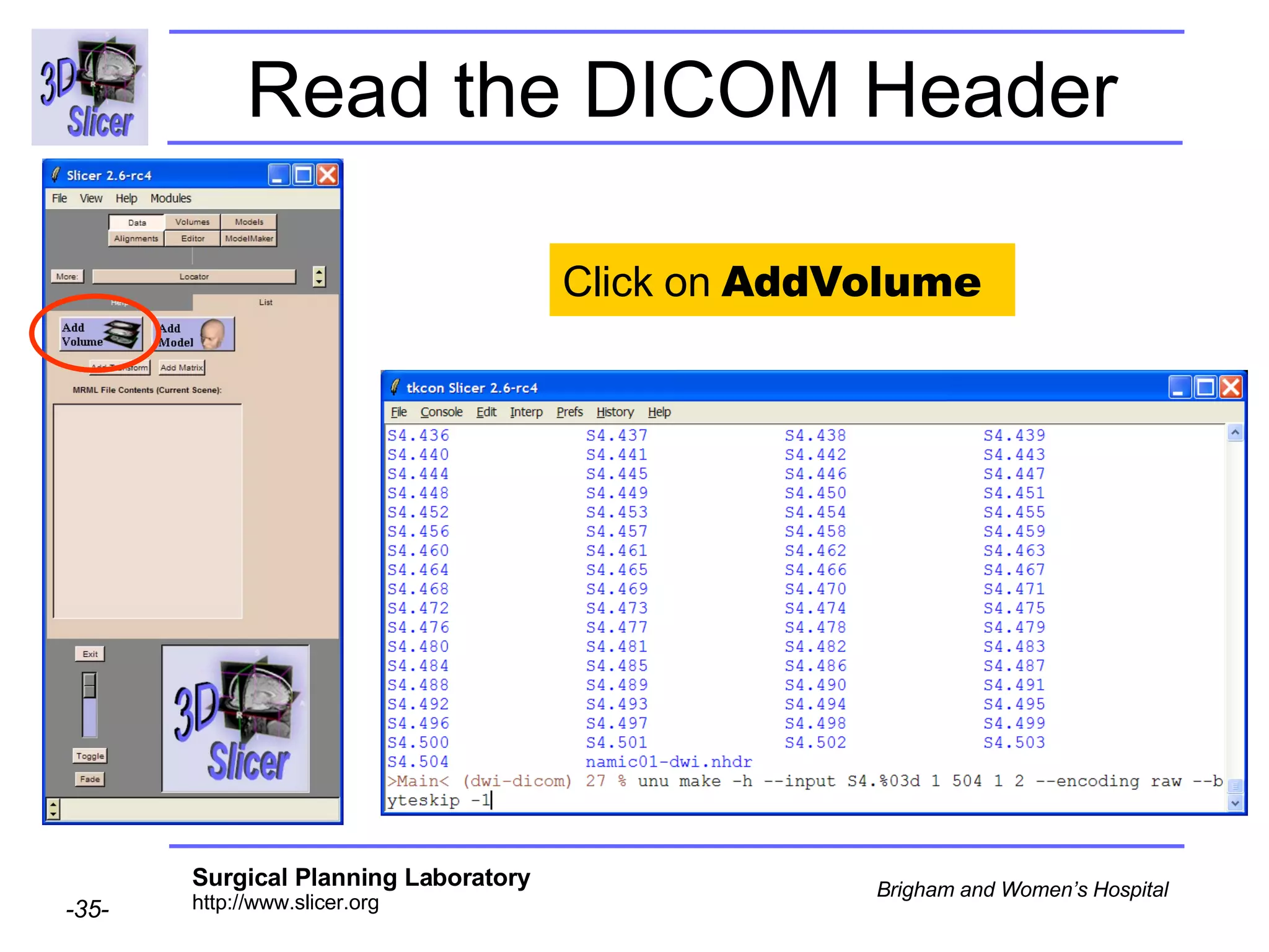 Read the DICOM Header Click on  AddVolume 