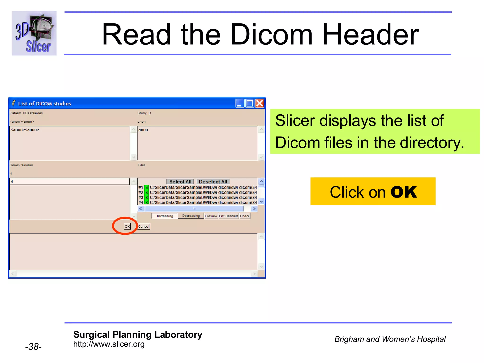 Read the Dicom Header Slicer displays the list of Dicom files in the directory. Click on  OK 