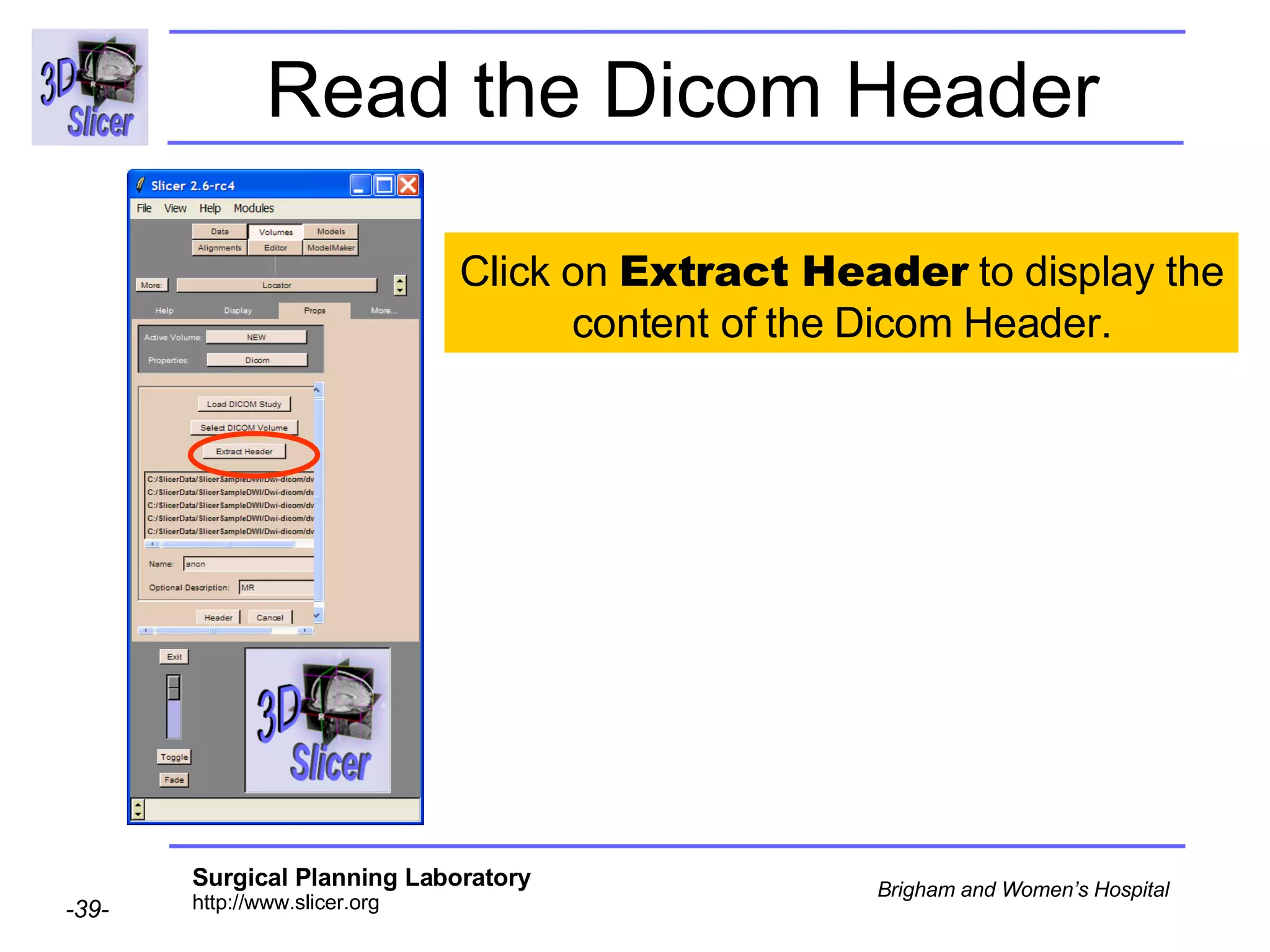 Read the Dicom Header Click on  Extract Header  to display the content of the Dicom Header. 