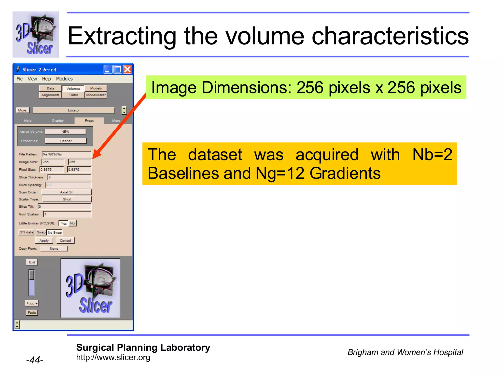 Extracting the volume characteristics The dataset was acquired with Nb=2 Baselines and Ng=12 Gradients  Image Dimensions: 256 pixels x 256 pixels 