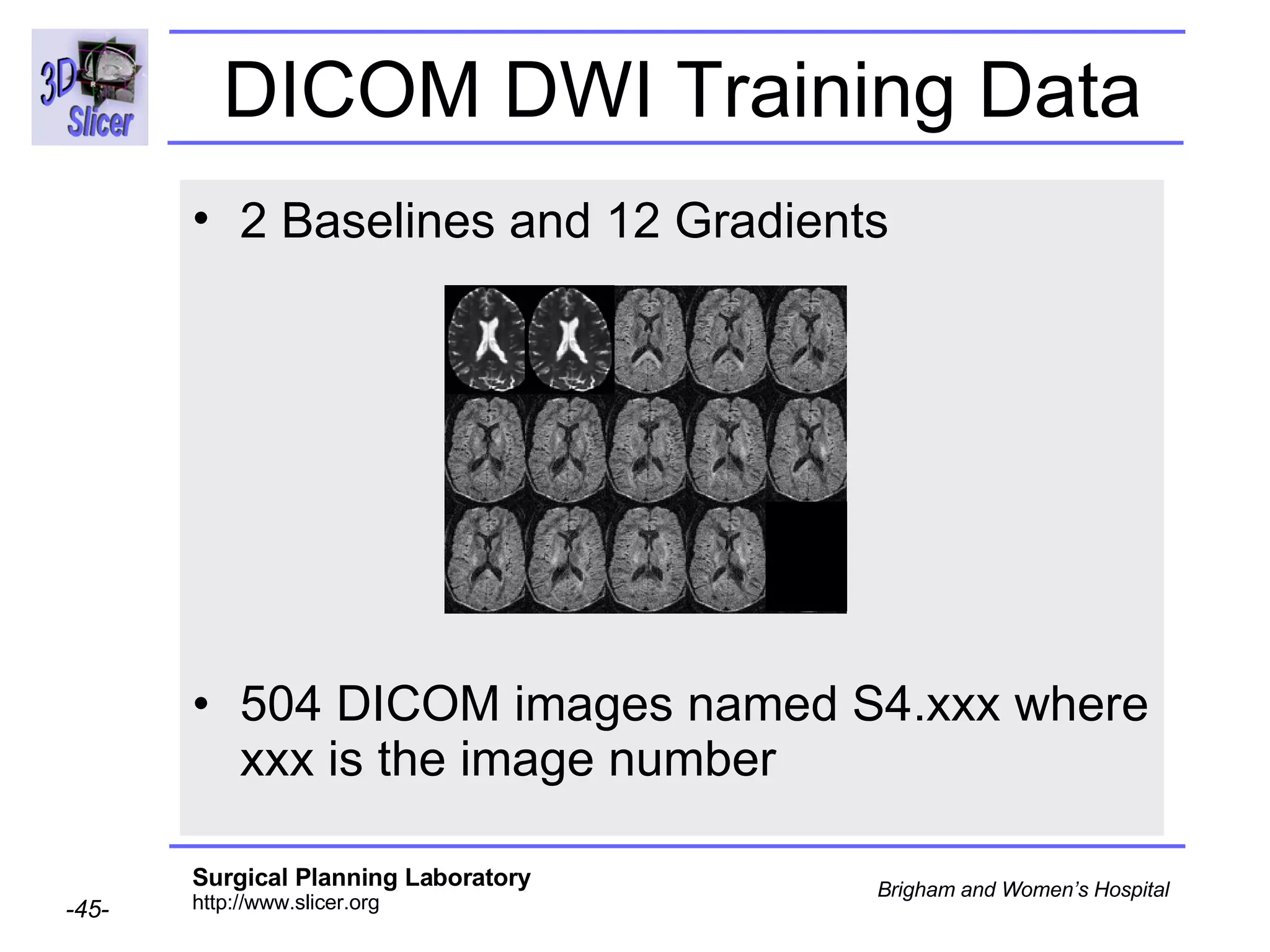 DICOM DWI Training Data 2 Baselines and 12 Gradients   504 DICOM images named S4.xxx where xxx is the image number 