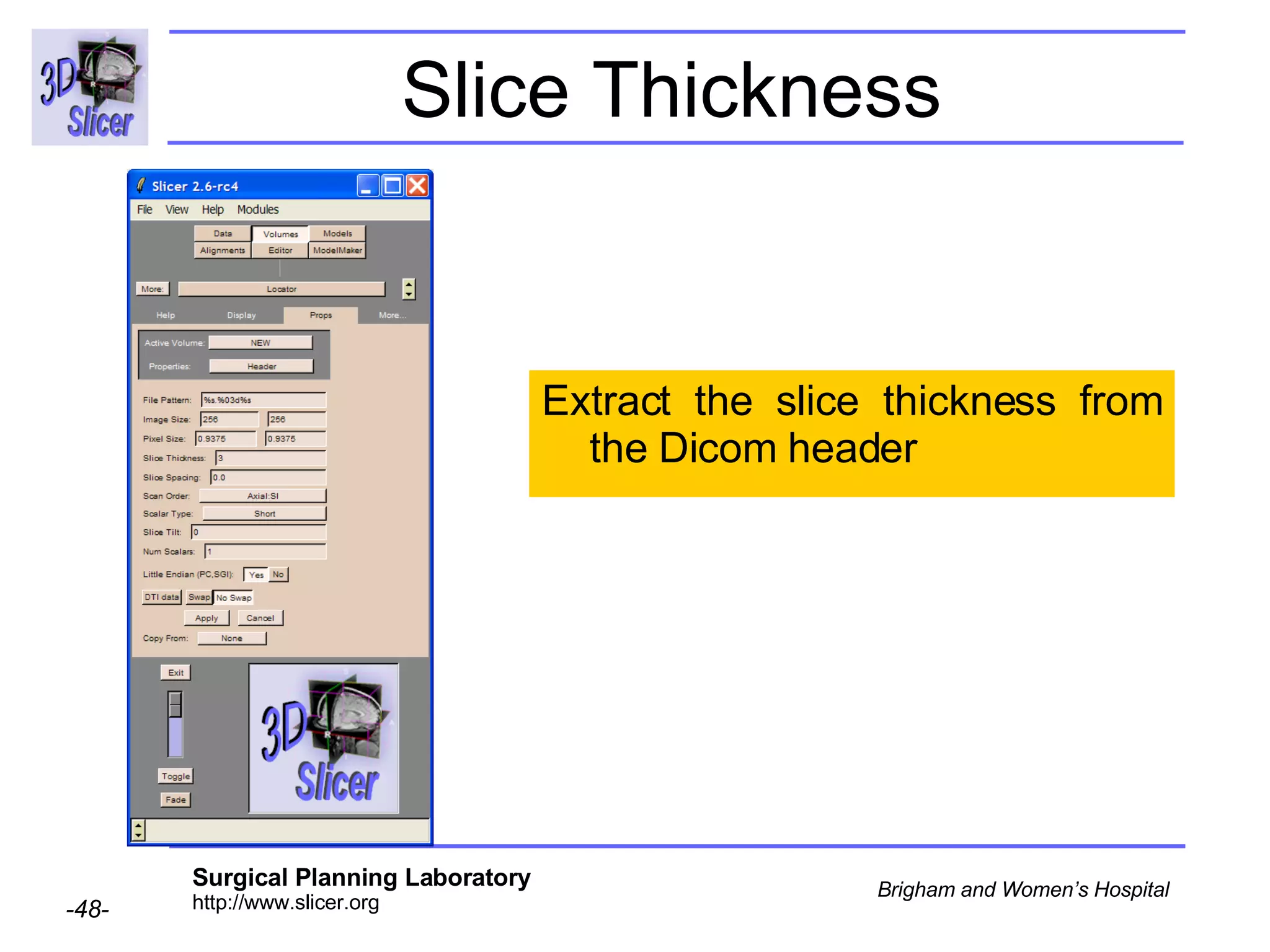 Slice Thickness  Extract the slice thickness from the Dicom header 