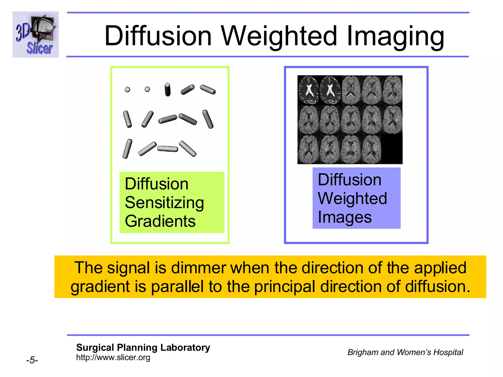 Diffusion Weighted Imaging The signal is dimmer when the direction of the applied gradient is parallel to the principal direction of diffusion. Diffusion Sensitizing Gradients  Diffusion Weighted  Images 