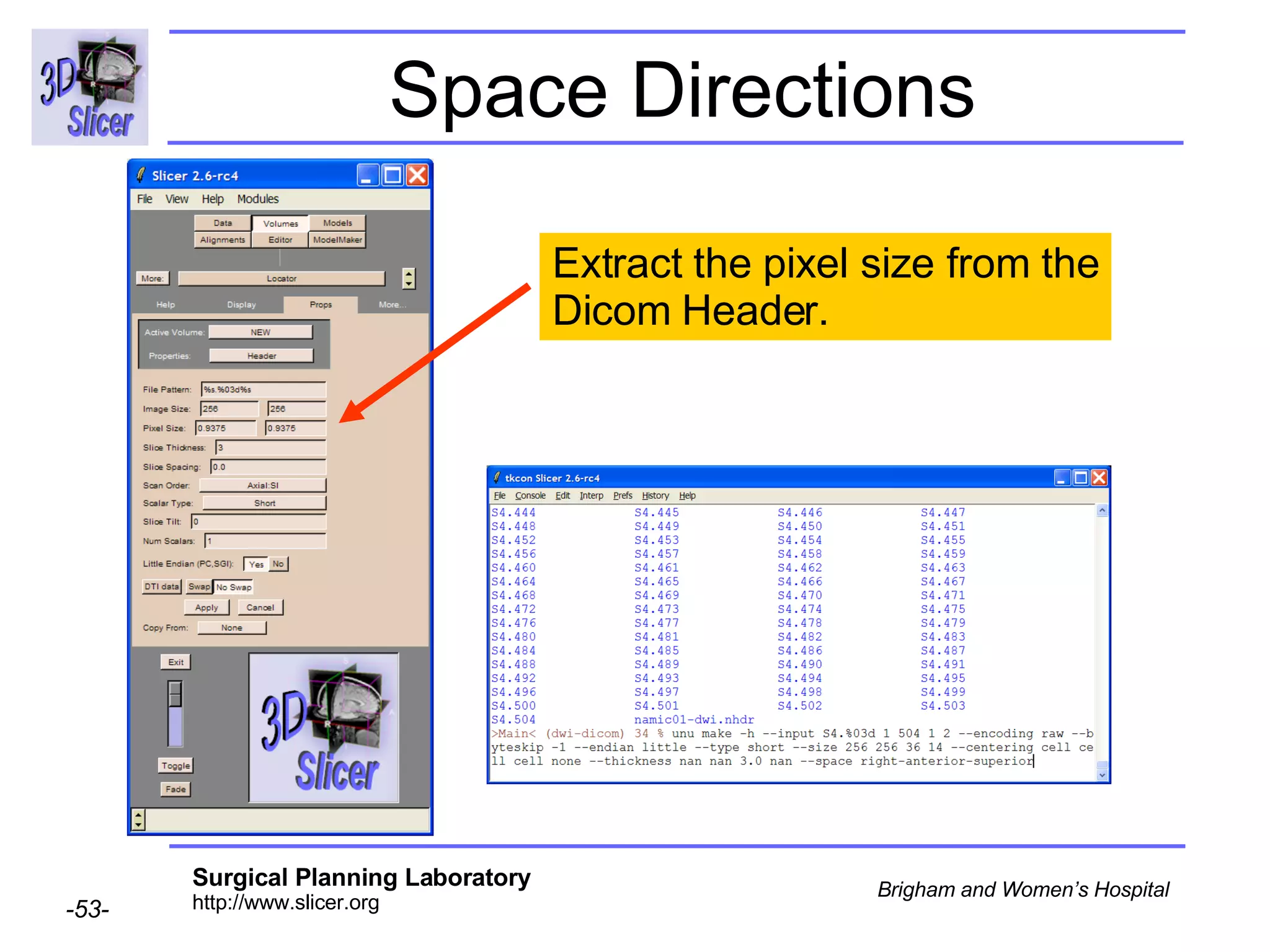 Space Directions Extract the pixel size from the Dicom Header. 