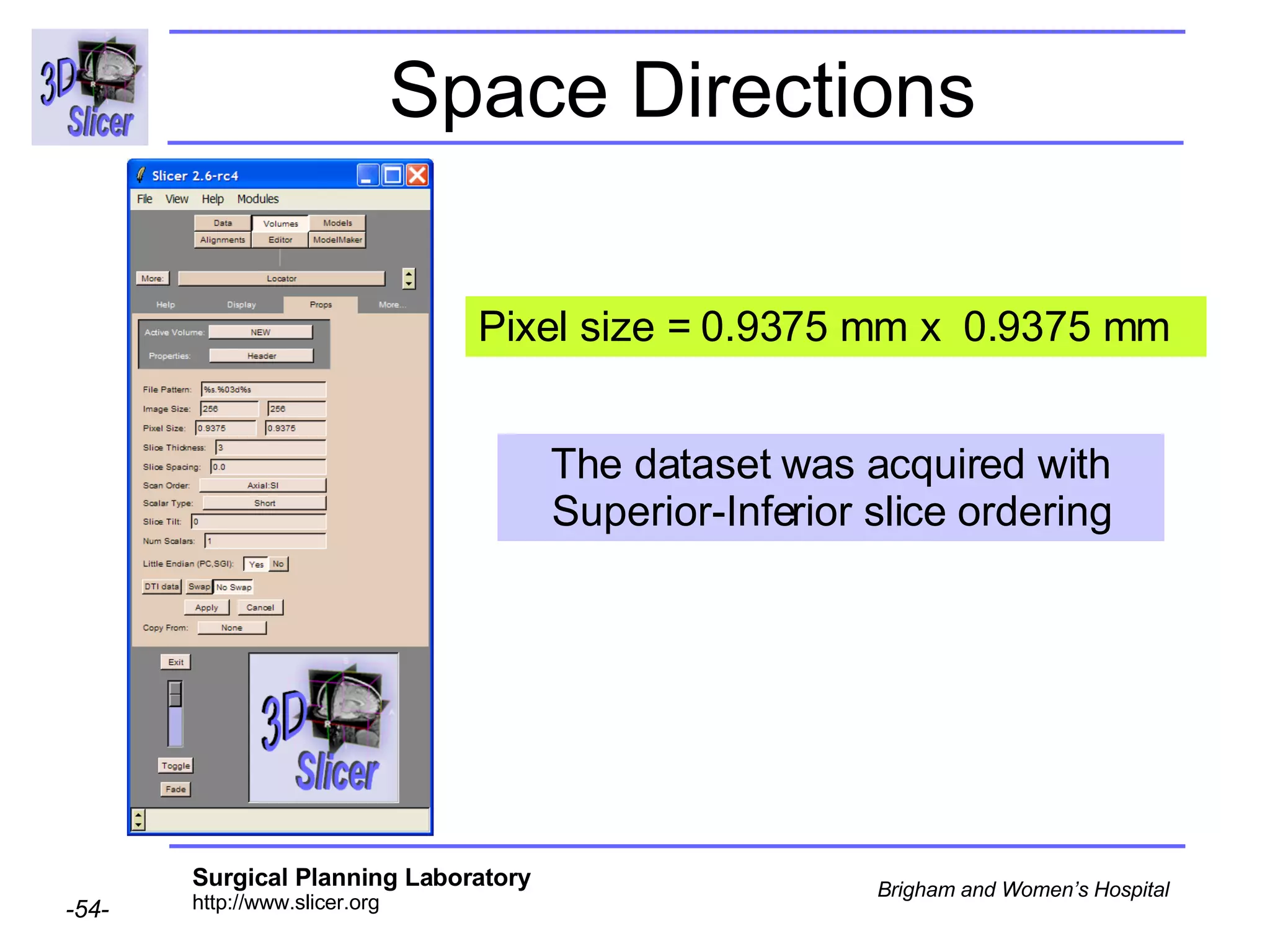 Space Directions Pixel size = 0.9375 mm x  0.9375 mm The dataset was acquired with Superior-Inferior slice ordering 