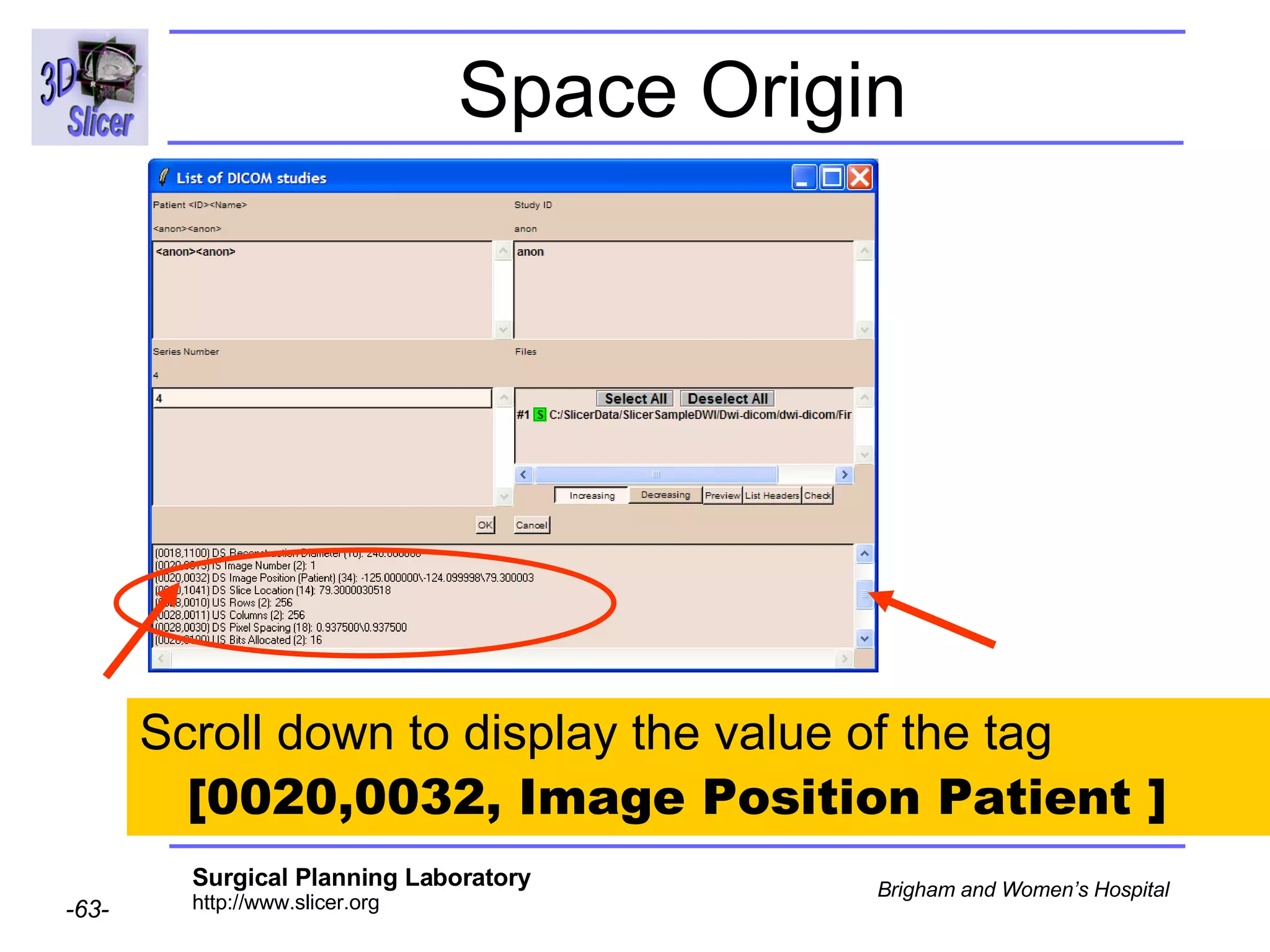 Space Origin Scroll down to display the value of the tag  [0020,0032, Image Position Patient ]  