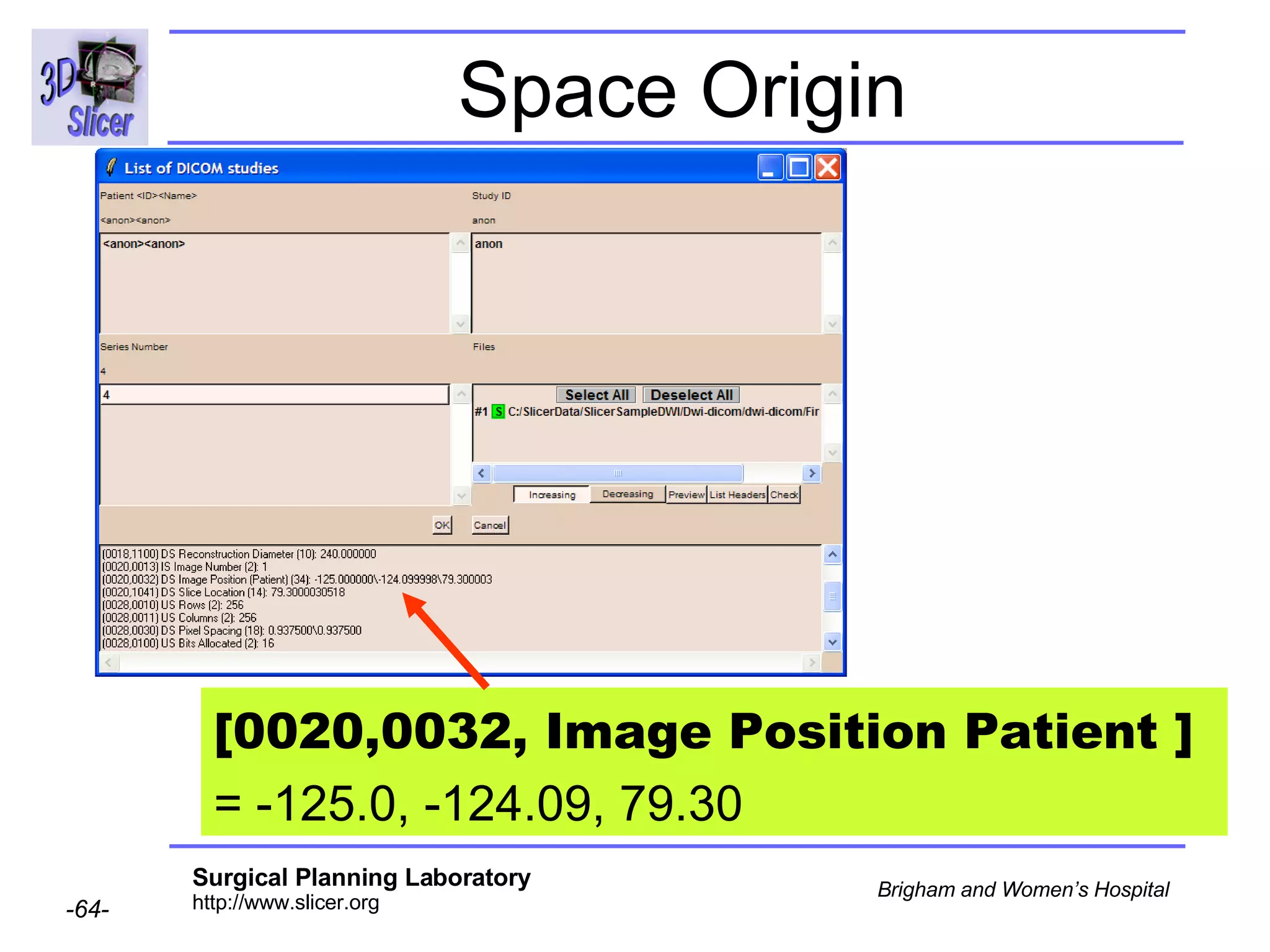 Space Origin [0020,0032, Image Position Patient ]   = -125.0, -124.09, 79.30  