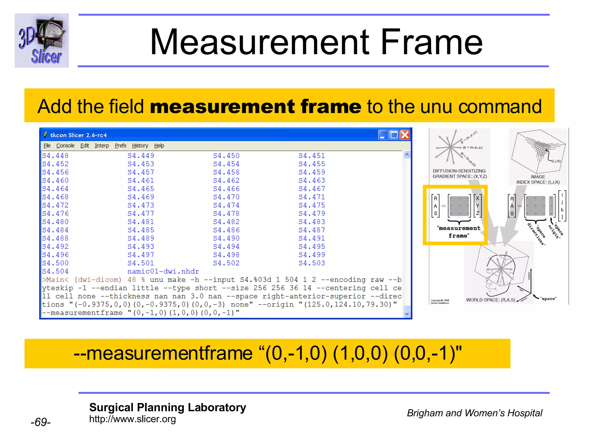 Measurement Frame --measurementframe “(0,-1,0) (1,0,0) (0,0,-1)" Add the field  measurement frame  to the unu command 