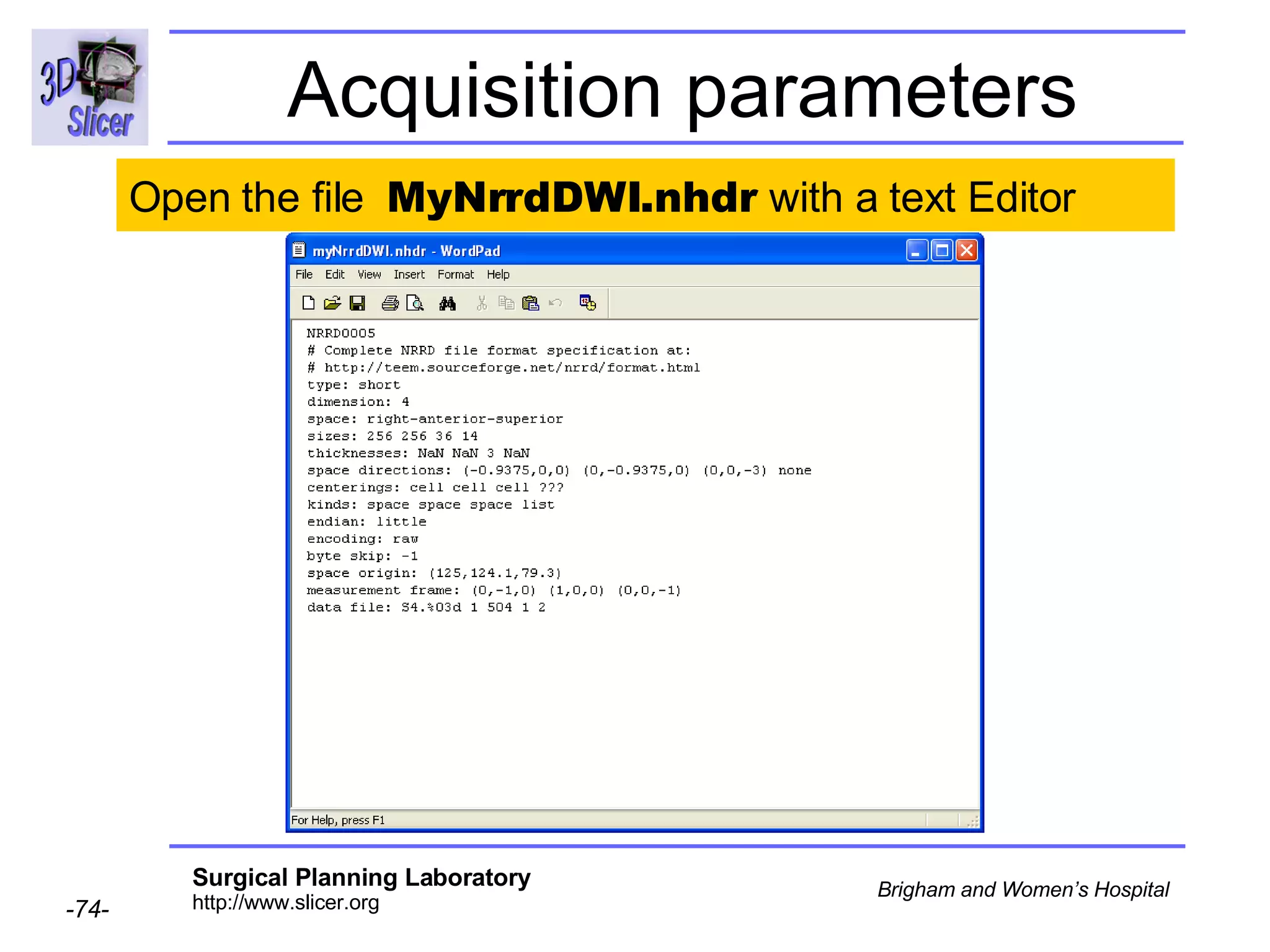 Acquisition parameters Open the file  MyNrrdDWI.nhdr  with a text Editor  