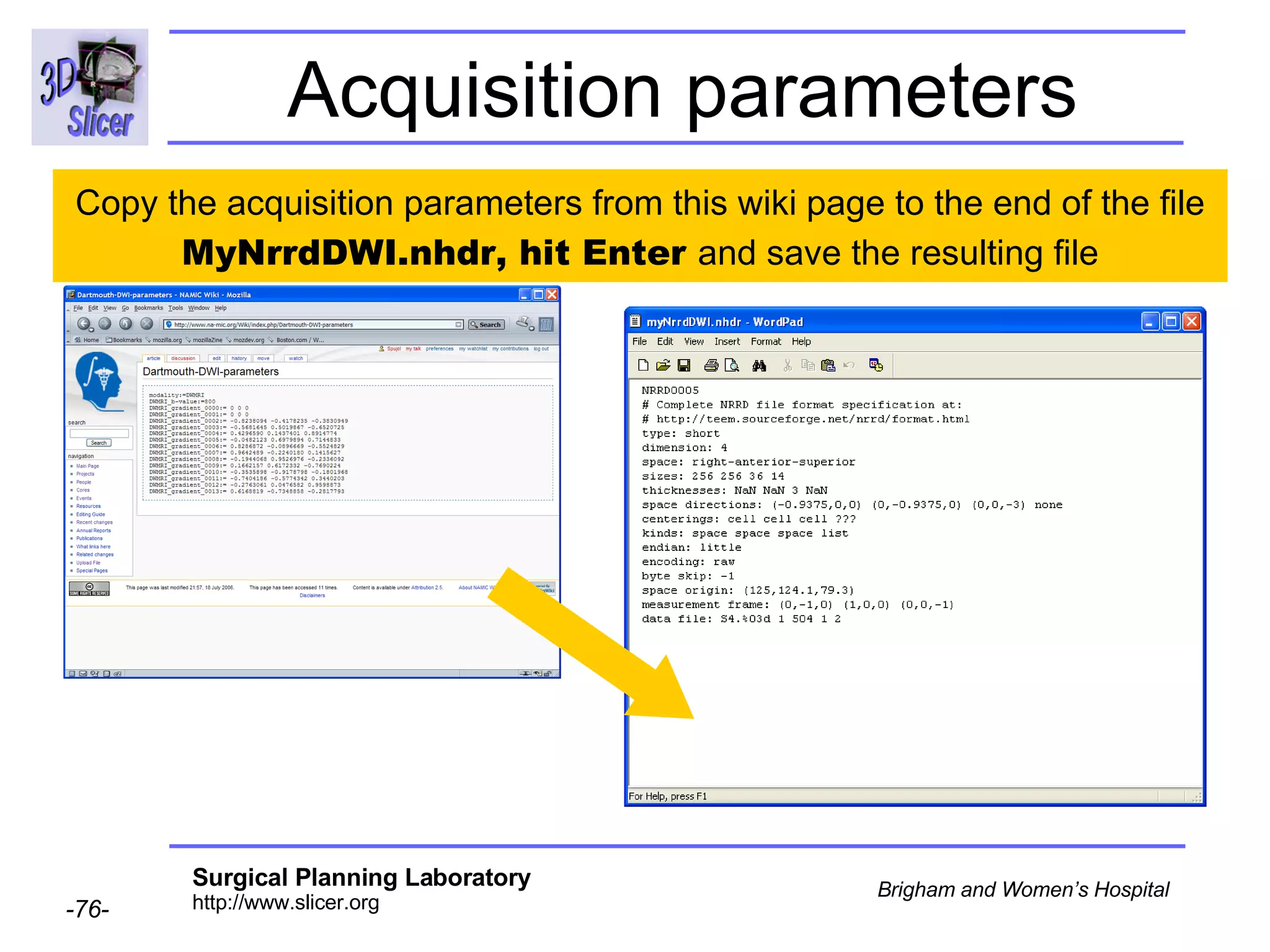 Acquisition parameters Copy the acquisition parameters from this wiki page to the end of the file  MyNrrdDWI.nhdr, hit Enter  and save the resulting file 