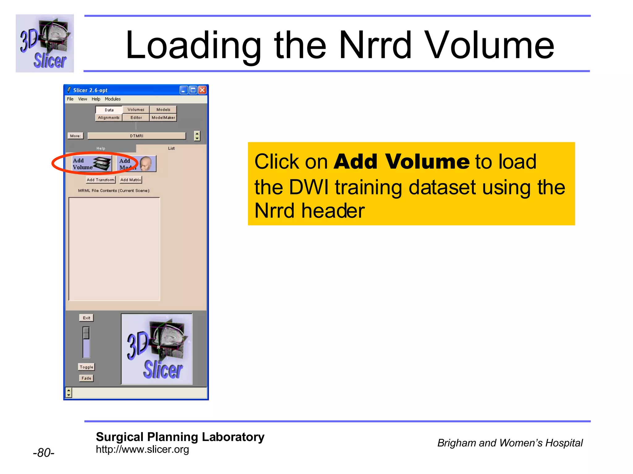 Loading the Nrrd Volume Click on  Add Volume  to load the DWI training dataset using the Nrrd header 