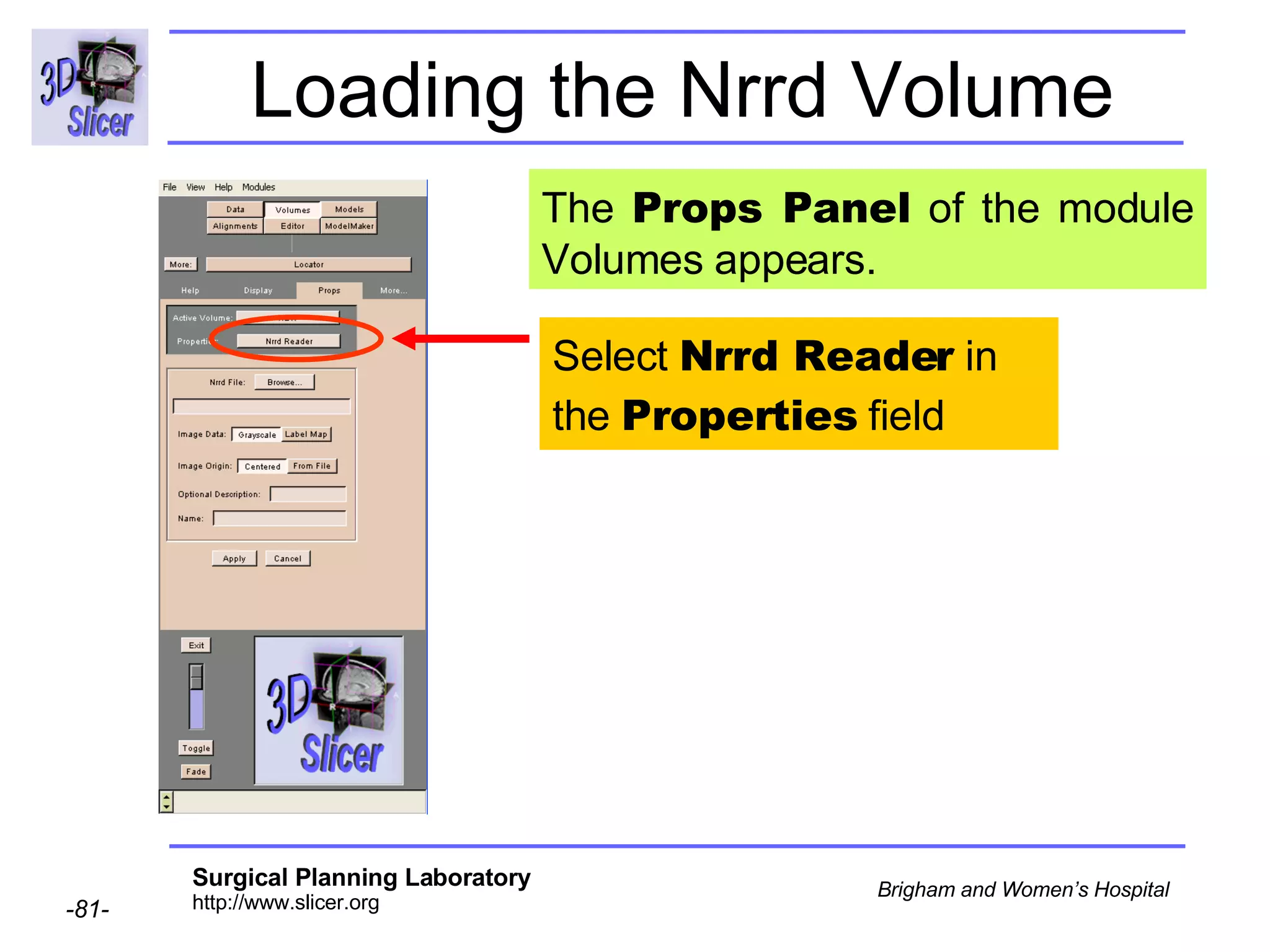 Loading the Nrrd Volume Select  Nrrd Reader  in the  Properties  field The  Props Panel  of the module Volumes appears. 