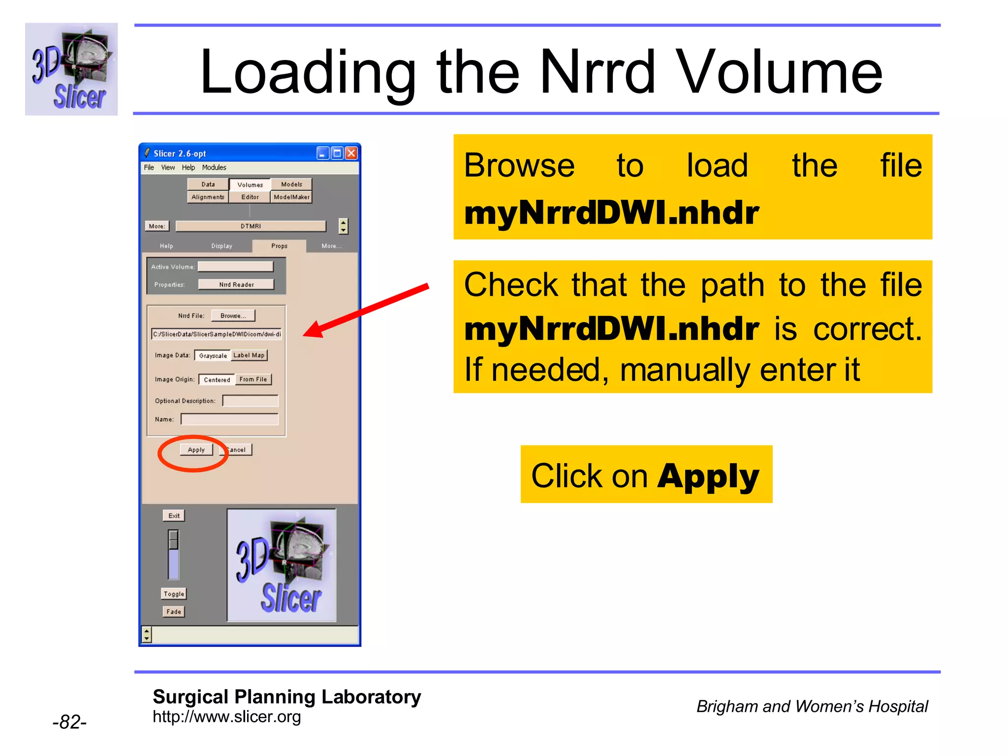 Loading the Nrrd Volume Click on  Apply Check that the path to the file  myNrrdDWI.nhdr  is correct. If needed, manually enter it Browse to load the file  myNrrdDWI.nhdr 