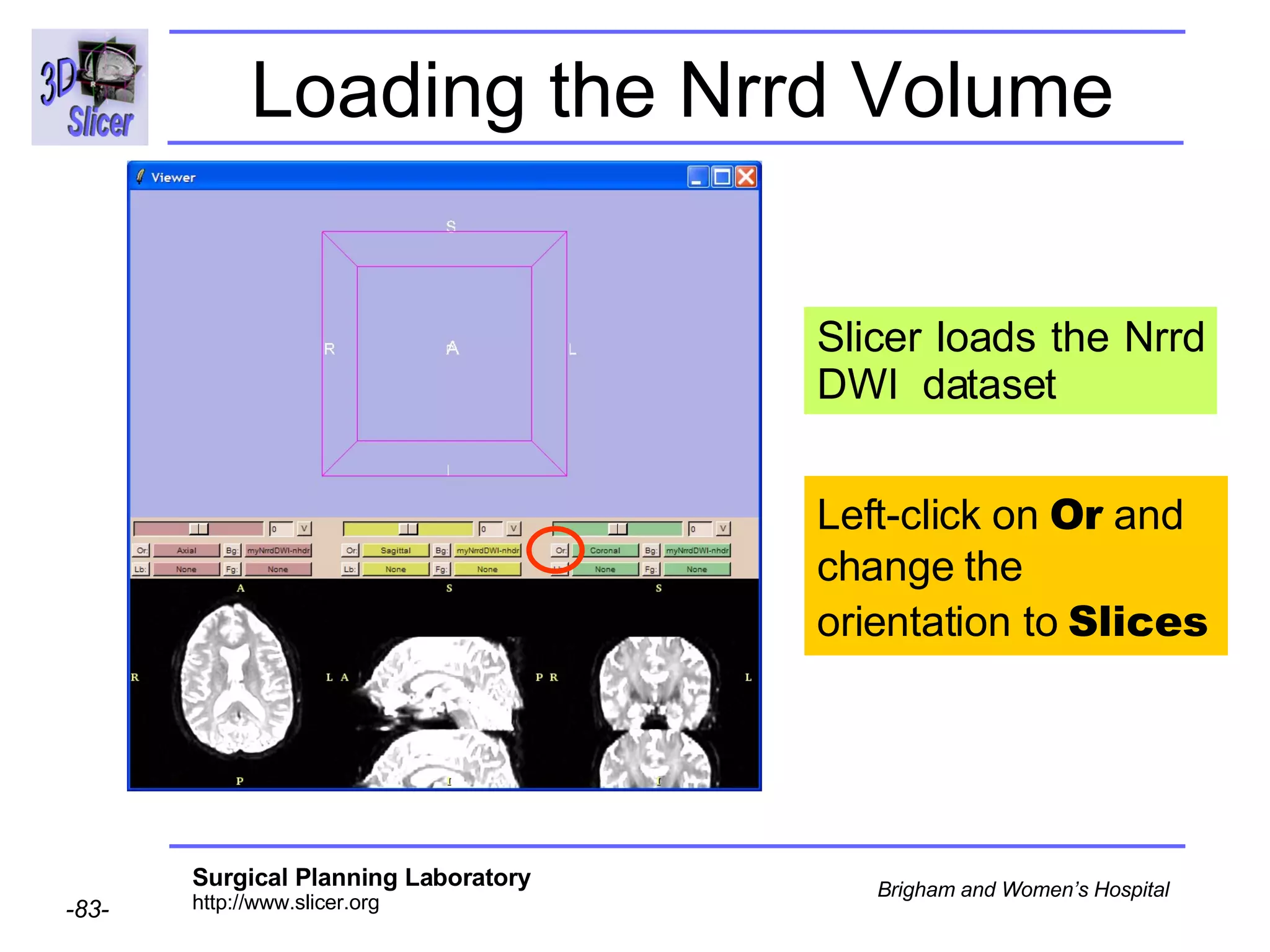Loading the Nrrd Volume Slicer loads the Nrrd DWI  dataset  Left-click on  Or  and change the orientation to  Slices 