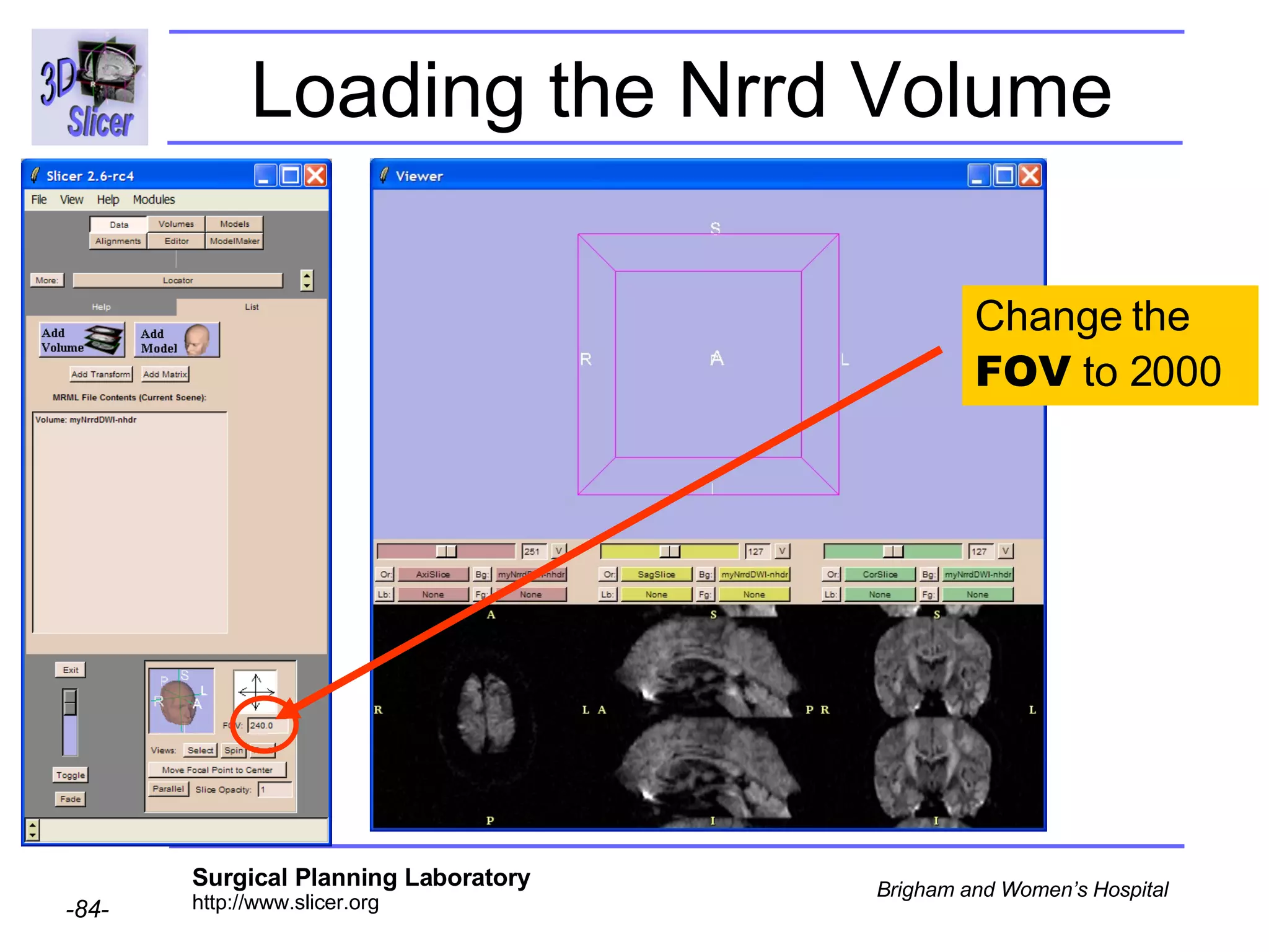 Loading the Nrrd Volume Change the  FOV  to 2000 