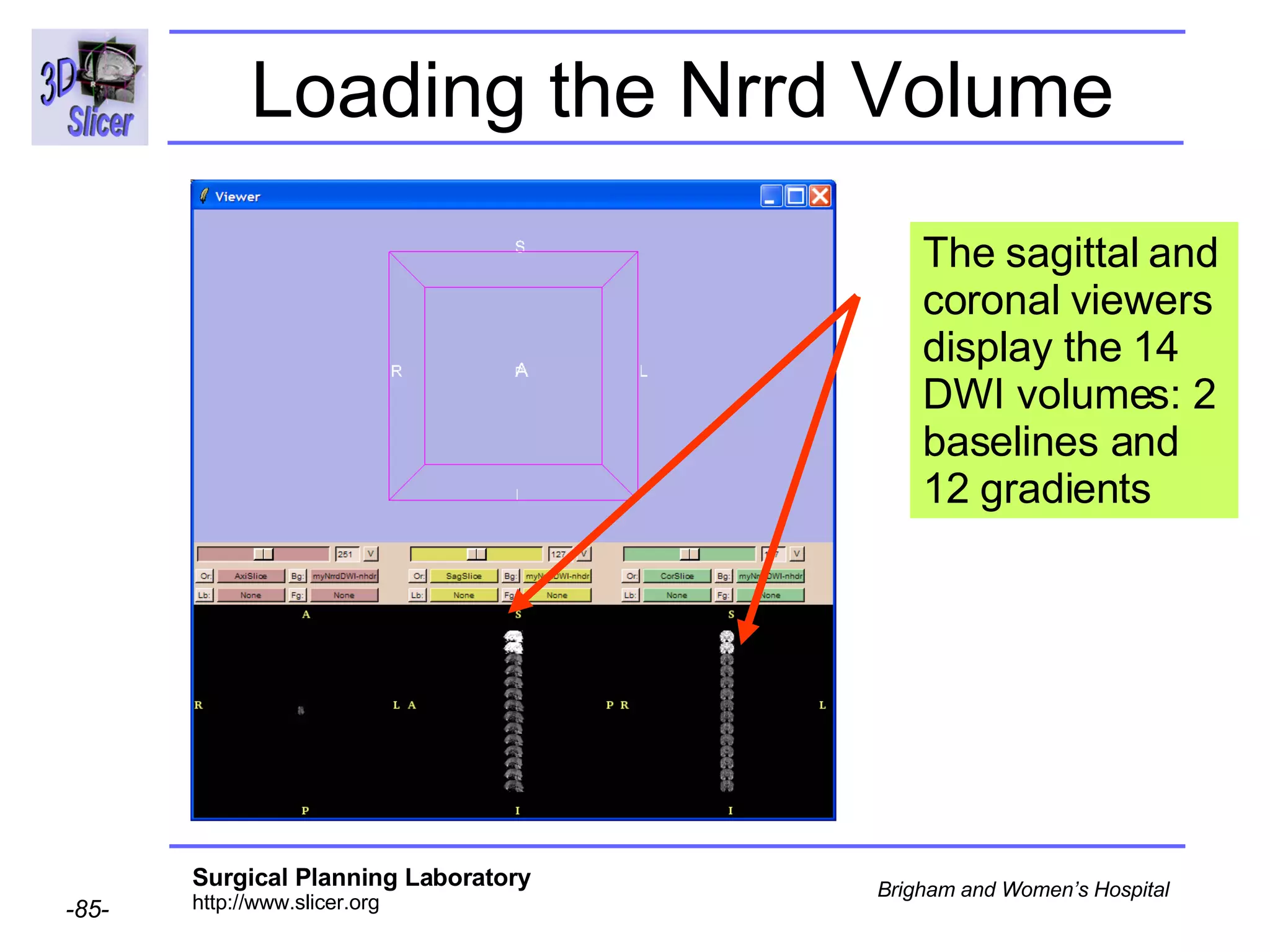 Loading the Nrrd Volume The sagittal and coronal viewers display the 14 DWI volumes: 2 baselines and 12 gradients  