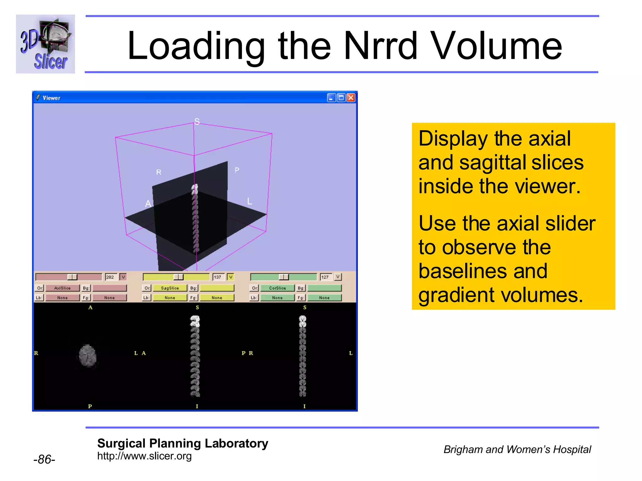 Loading the Nrrd Volume Display the axial and sagittal slices inside the viewer. Use the axial slider to observe the baselines and gradient volumes. 