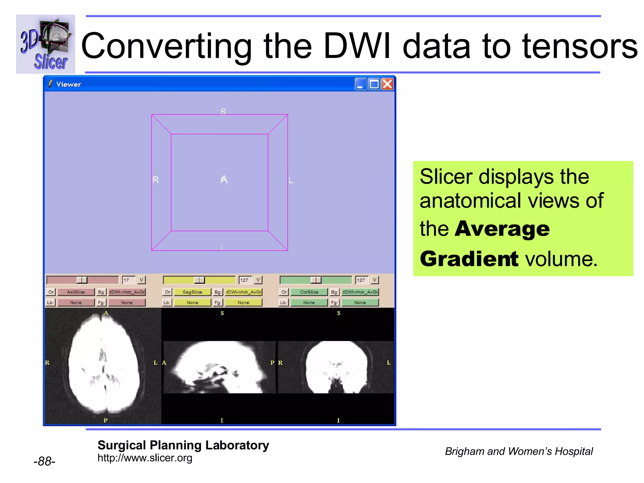 Converting the DWI data to tensors Slicer displays the anatomical views of the  Average Gradient  volume. 