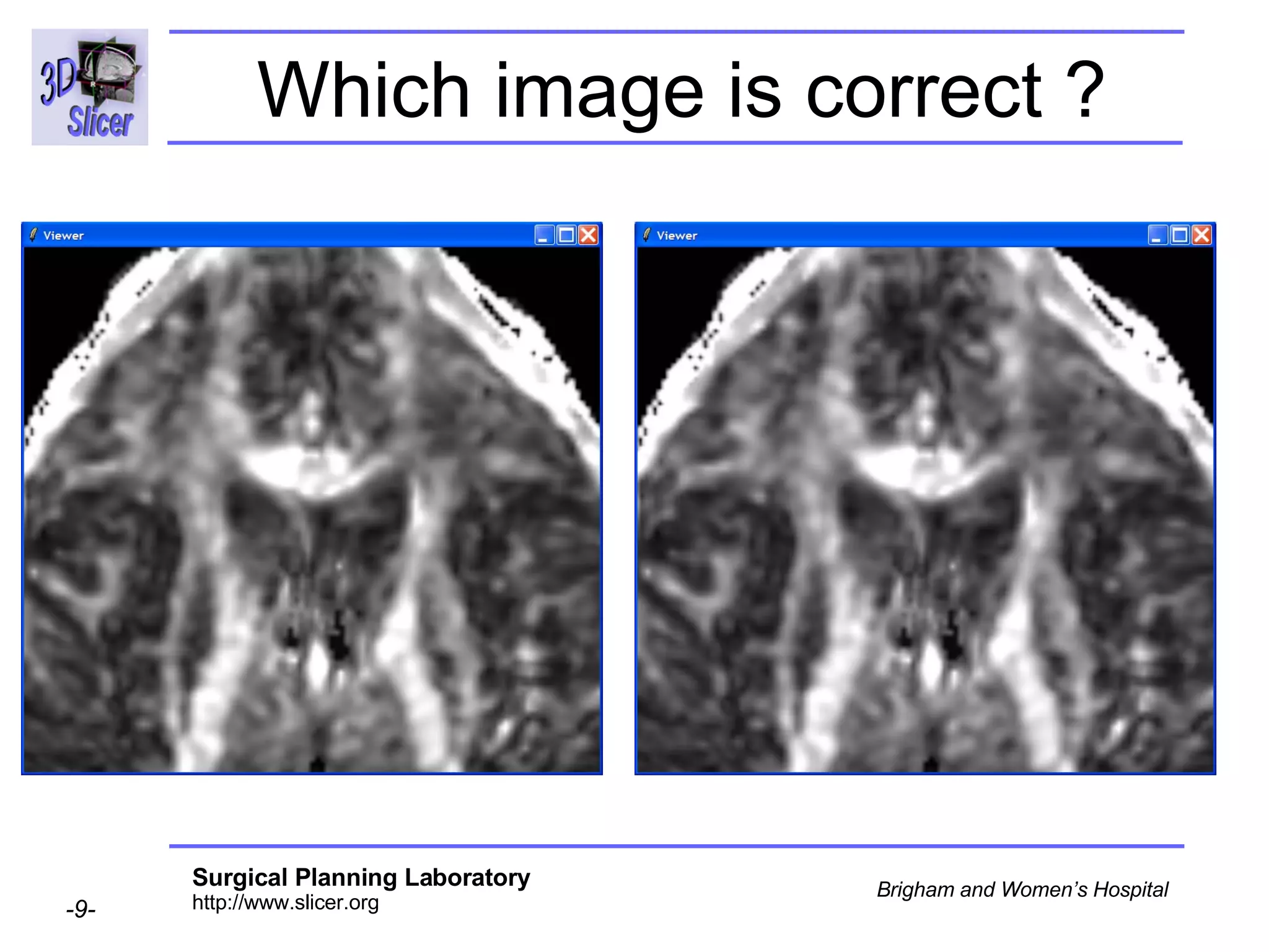 Which image is correct ? 